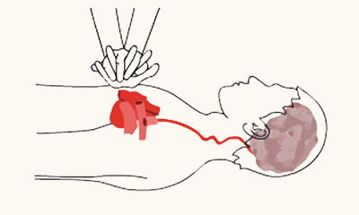 3.gif